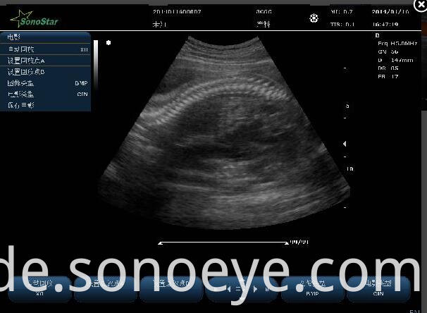 C10 Color Doppler Ultrasound System For Hostipal